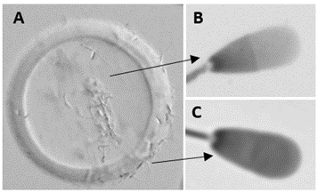 Figure 1 shows the ZP of bovine oocyte being penetrated by sperm cells after 3 hours of coincubation (A). The image highlights the differences between sperm that have successfully penetrated the ZP (B), without the acrosome, and those that have not and still retain the acrosome (C). 